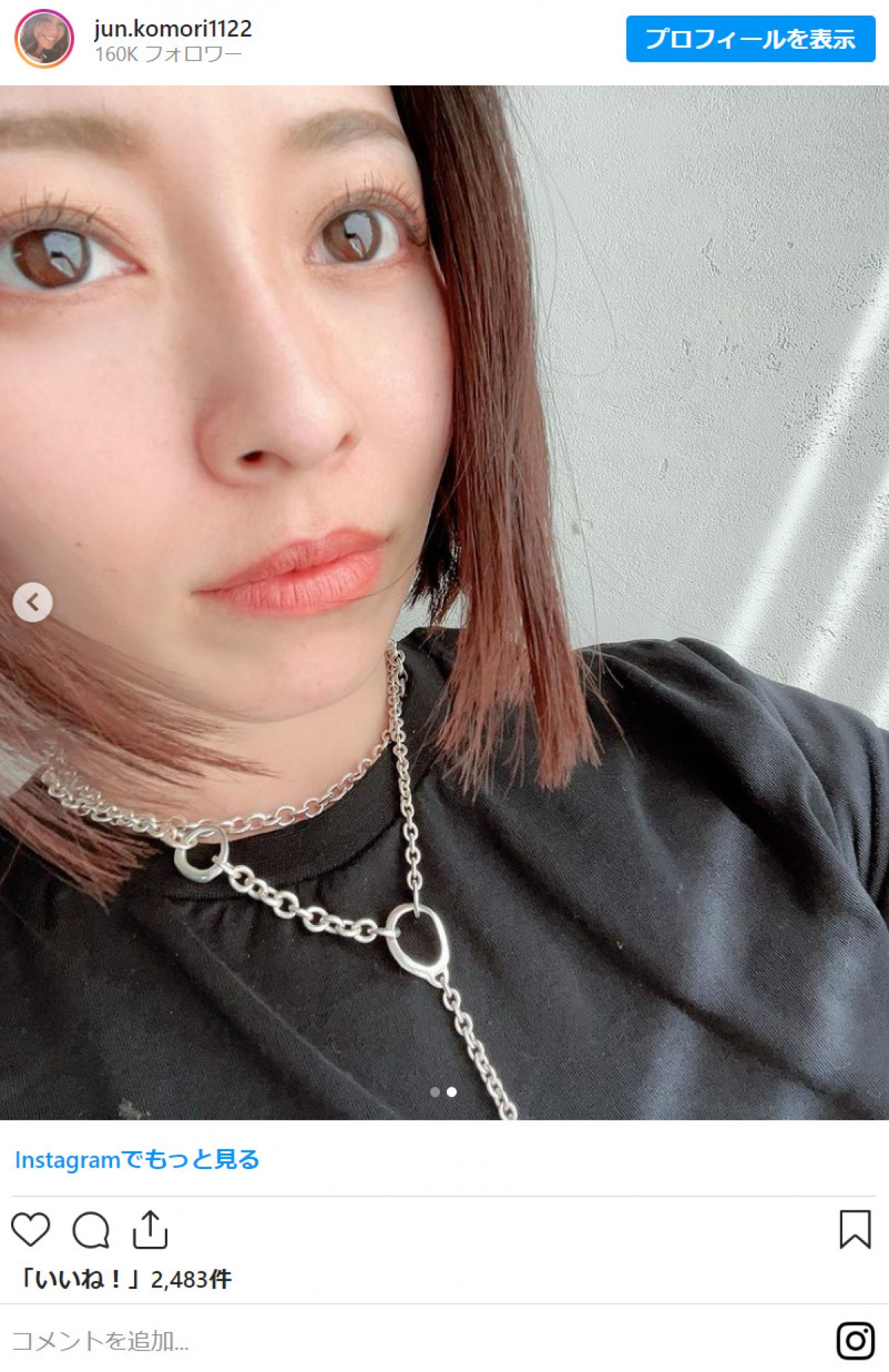 小森純37歳、「産後絶対やりたかった」ヘアカット＆美容医療で美人化　「むっちゃ綺麗」と反響