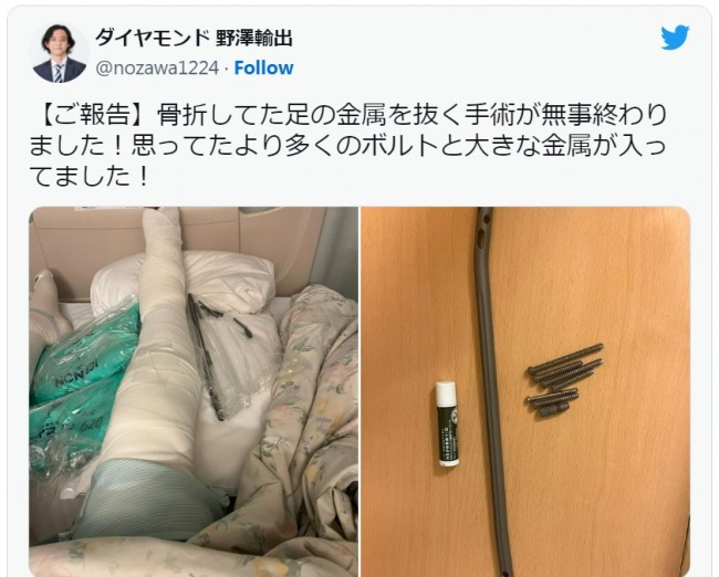 野澤輸出、体内から金属を取り出す手術が完了　　※「野澤輸出（ダイヤモンド）」ツイッター