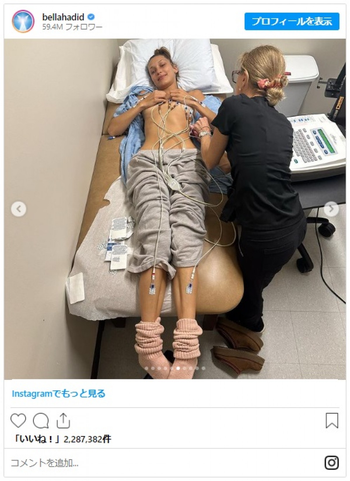 ベラ・ハディッド、ライム病治療の写真を公開　約15年に及ぶ闘病を語る