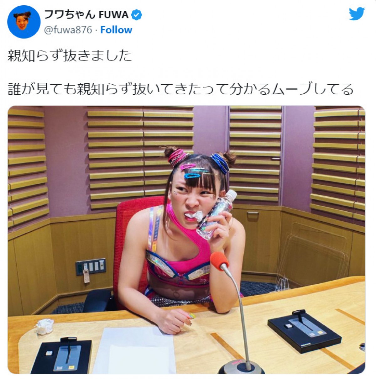 フワちゃん、親知らず抜歯で「誰が見ても分かる」ムーブ披露 ※「フワちゃん」ツイッター