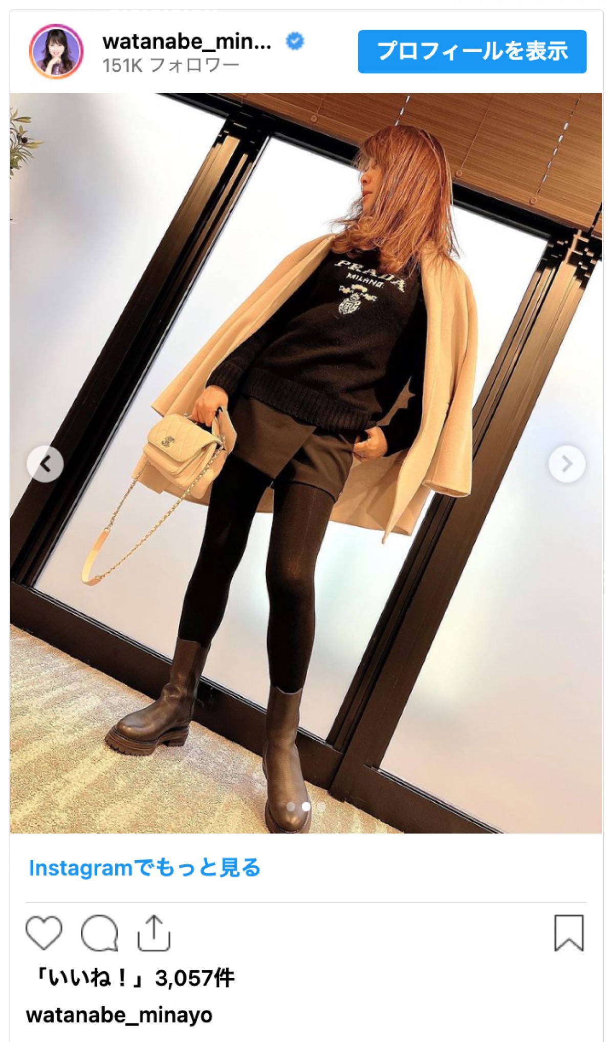渡辺美奈代、美脚際立つミニ丈パンツコーデに反響「スタイル抜群です」「めちゃくちゃ細い」