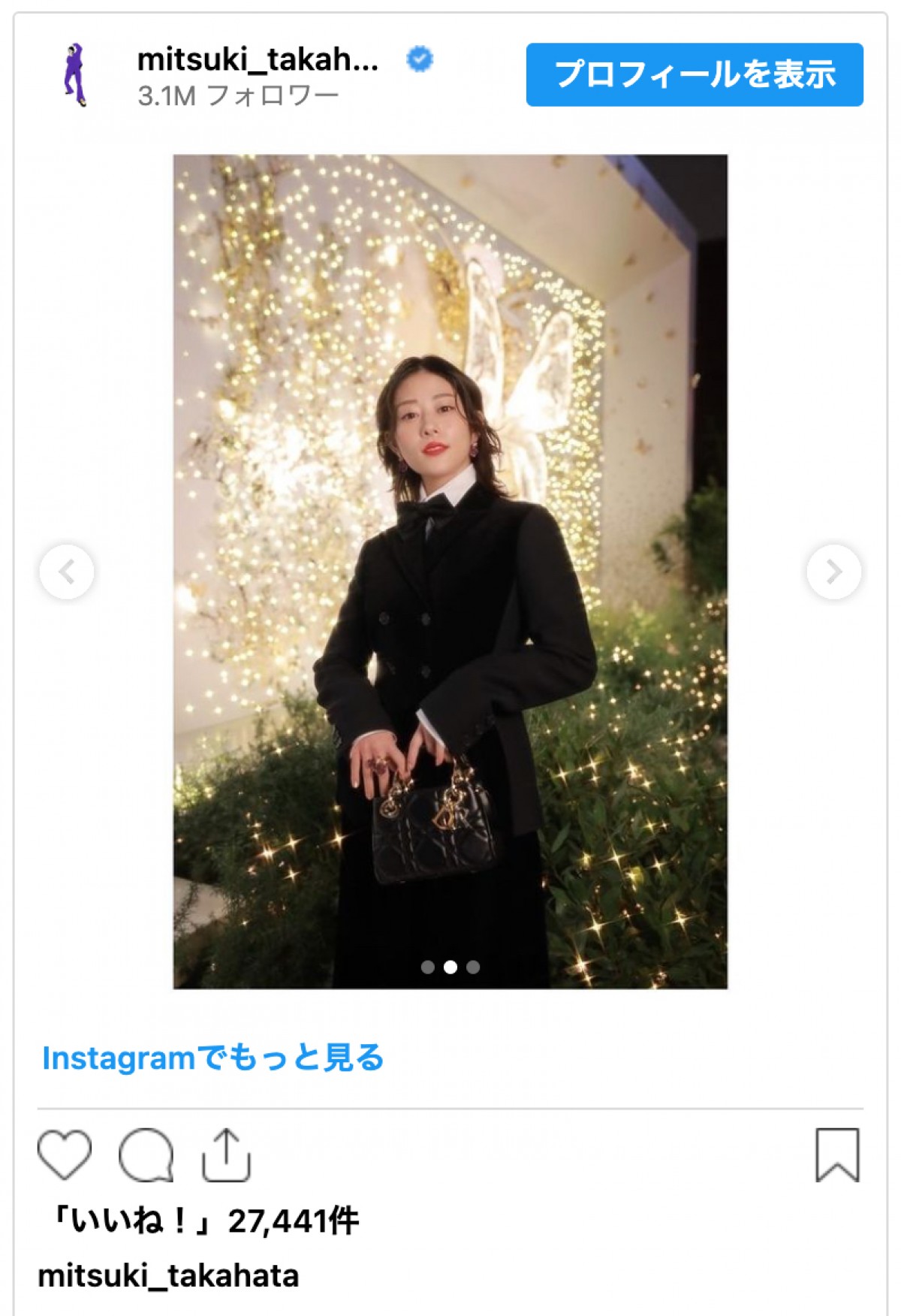 高畑充希「コナンくんです」蝶ネクタイつけた姿に反響