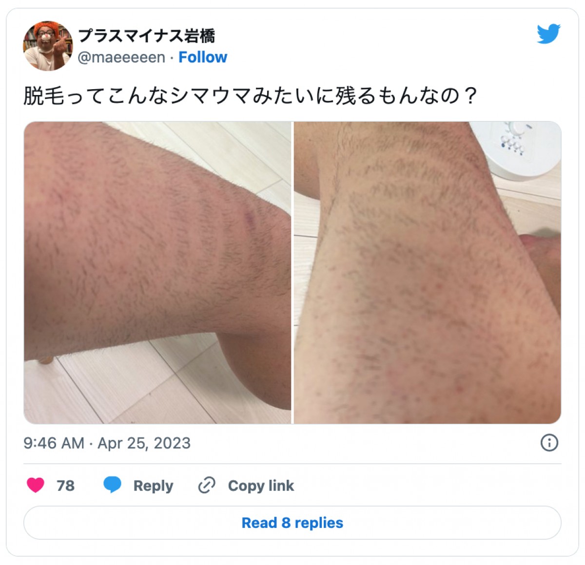“脚脱毛”で毛が残った岩橋良昌の脚　※「プラス・マイナス岩橋良昌」ツイッター