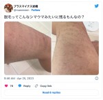 プラス・マイナス岩橋、“脚脱毛”でなぜか「シマウマみたい」に　「田植えしたみたい」「里芋にも見える」の声