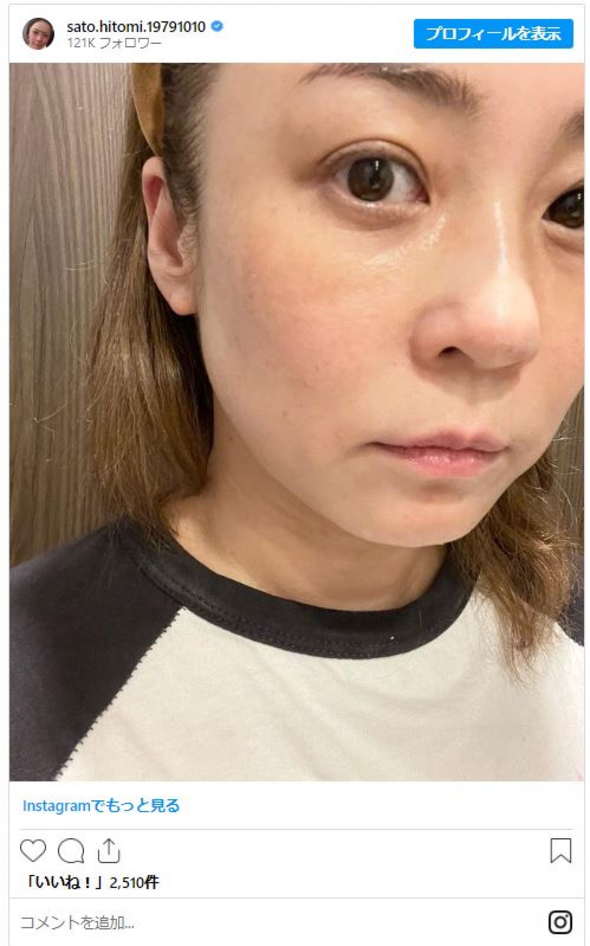 山下美月、Matt、高岡早紀も美肌披露、芸能人の“すっぴん”姿　「10代みたい」「ほんっとーに可愛い」