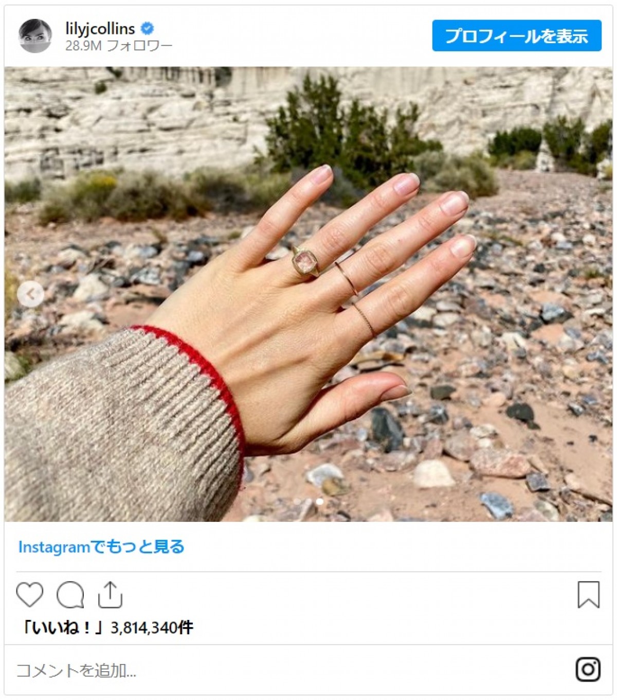 リリー・コリンズ、スパで婚約指輪と結婚指輪を盗まれる