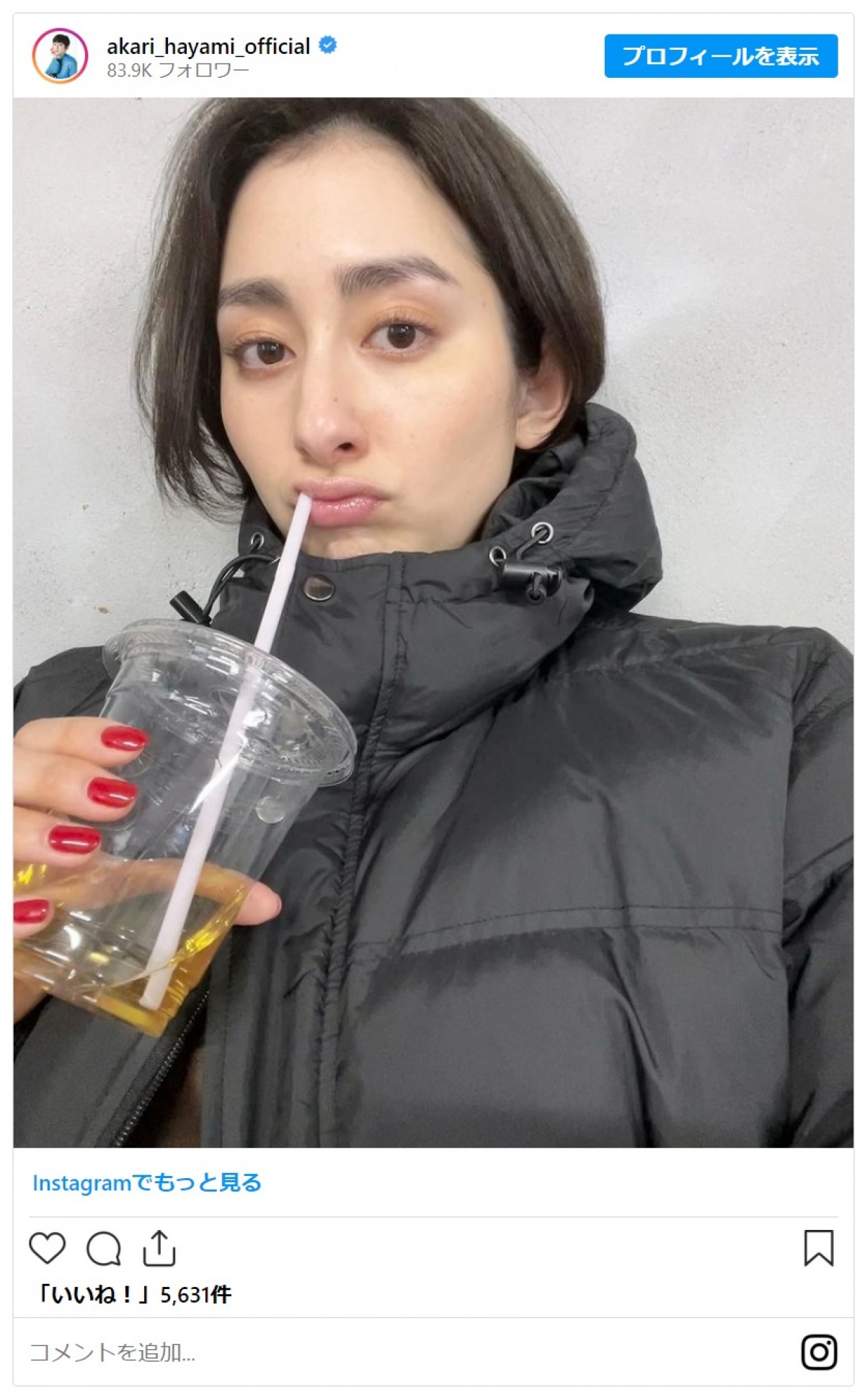 鷲見玲奈に秋元真夏も！　髪バッサリで激的イメチェンの美女たち