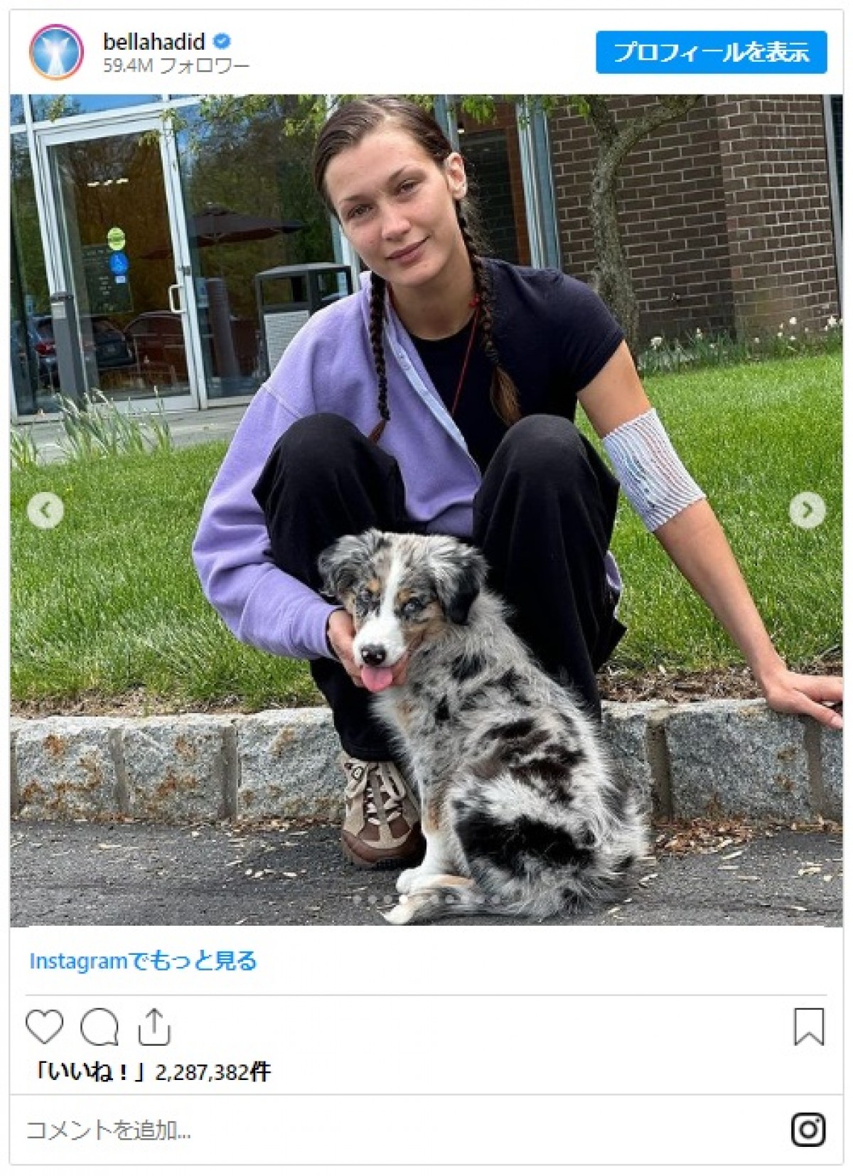 ベラ・ハディッド、ライム病治療の写真を公開　約15年に及ぶ闘病を語る