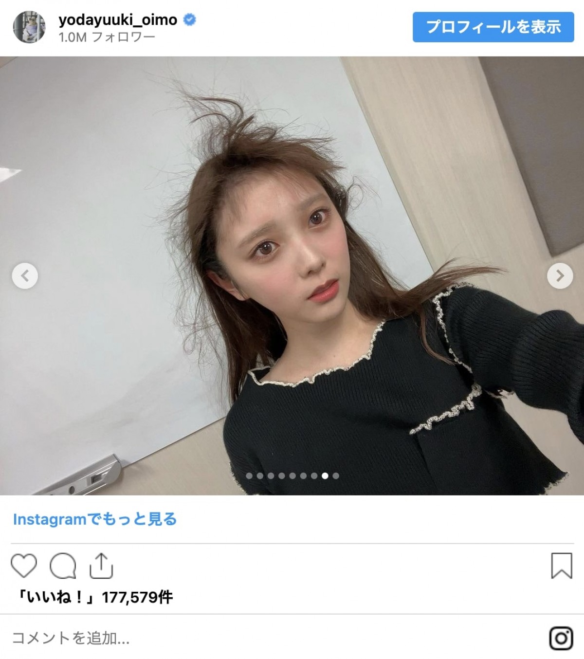 芸能界に“アーニャ”大量発生！　「完成度120％」から「とりあえず謝ろっか」な変身までイッキ見
