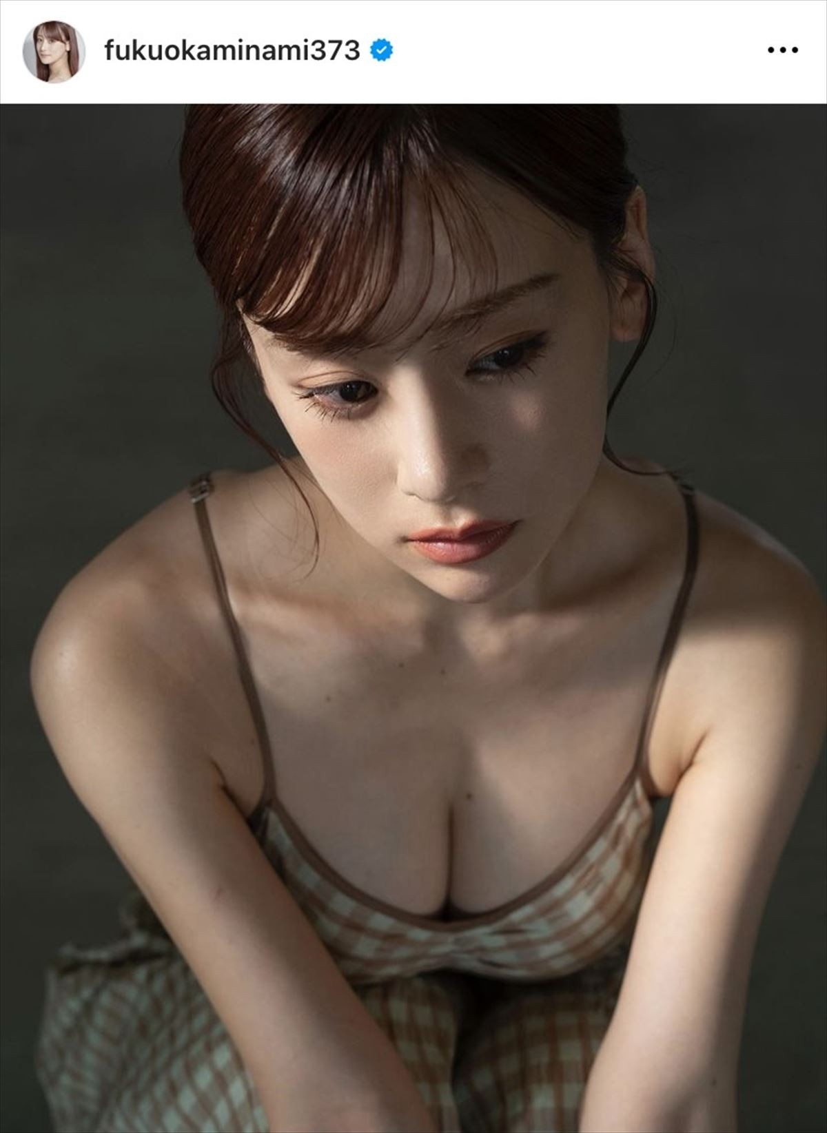 「お仕事のメールが返ってこないと連絡いただいていますが」“整形1億円”タレント、SNSで状況を説明