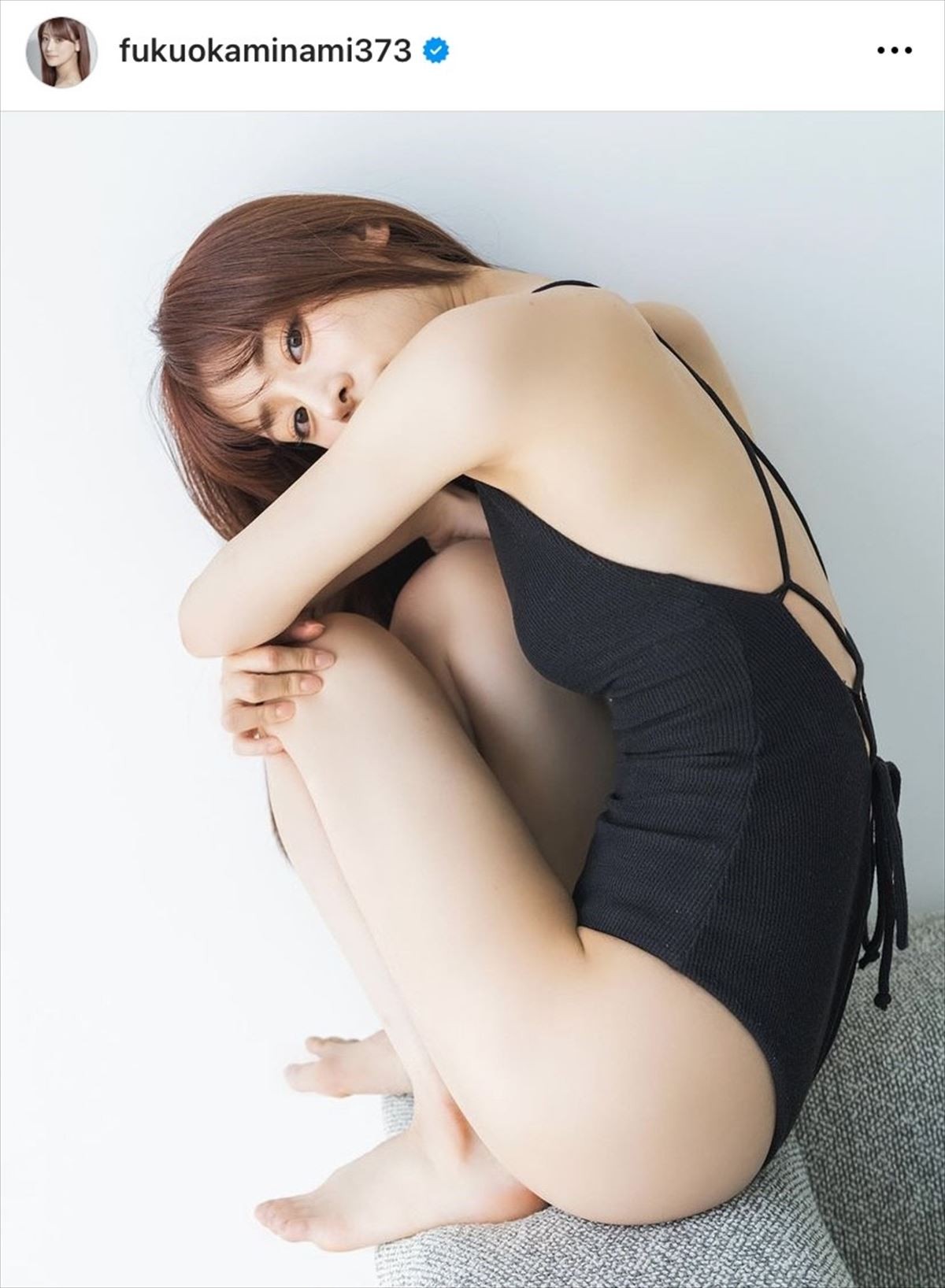 「お仕事のメールが返ってこないと連絡いただいていますが」“整形1億円”タレント、SNSで状況を説明