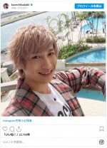 歯列矯正前の兼近大樹 ※「EXIT・兼近大樹」インスタグラム