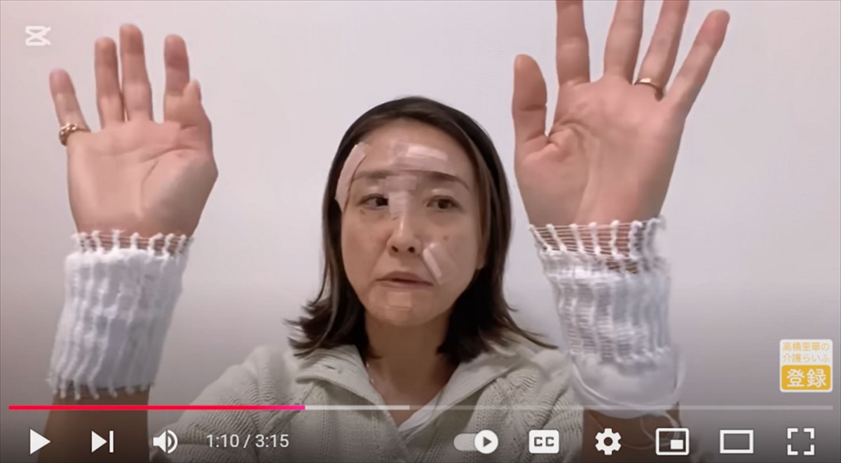 元国民的美少女タレント「顔面を大火傷しました」　ファン心配「痛々しい」「キレイなお顔が、、」