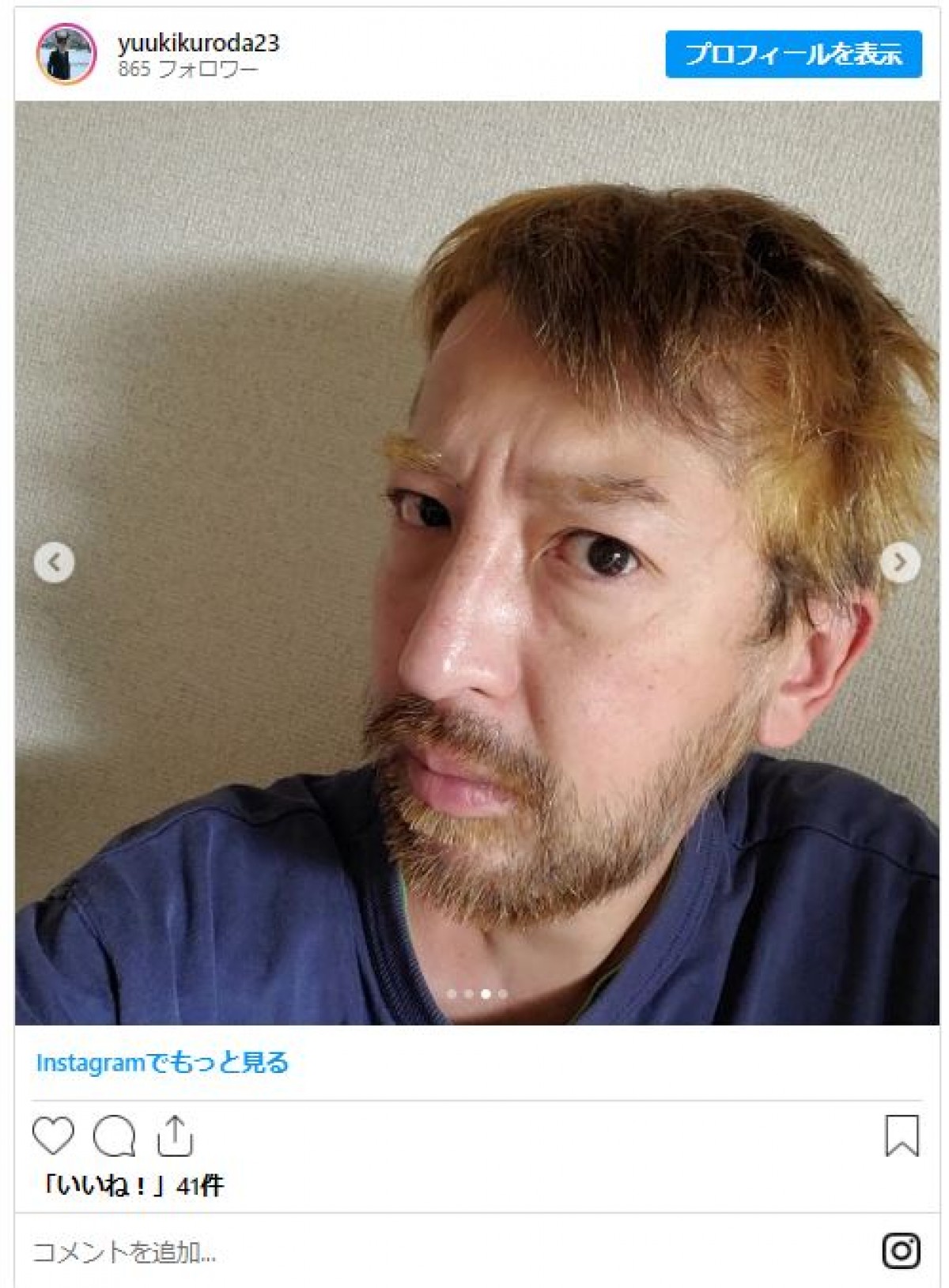 元天才子役・黒田勇樹「悪名もなんちゃらなんで、ありがたいですが」　自身のネットニュースに反応