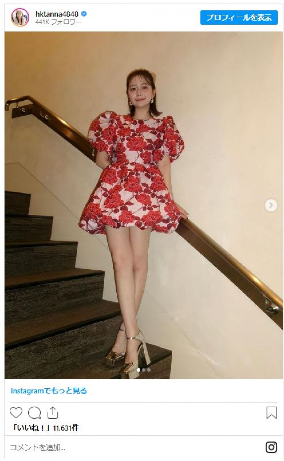 村重杏奈「五億万年ぶりに足を出しました」　レアなミニスカ姿に反響