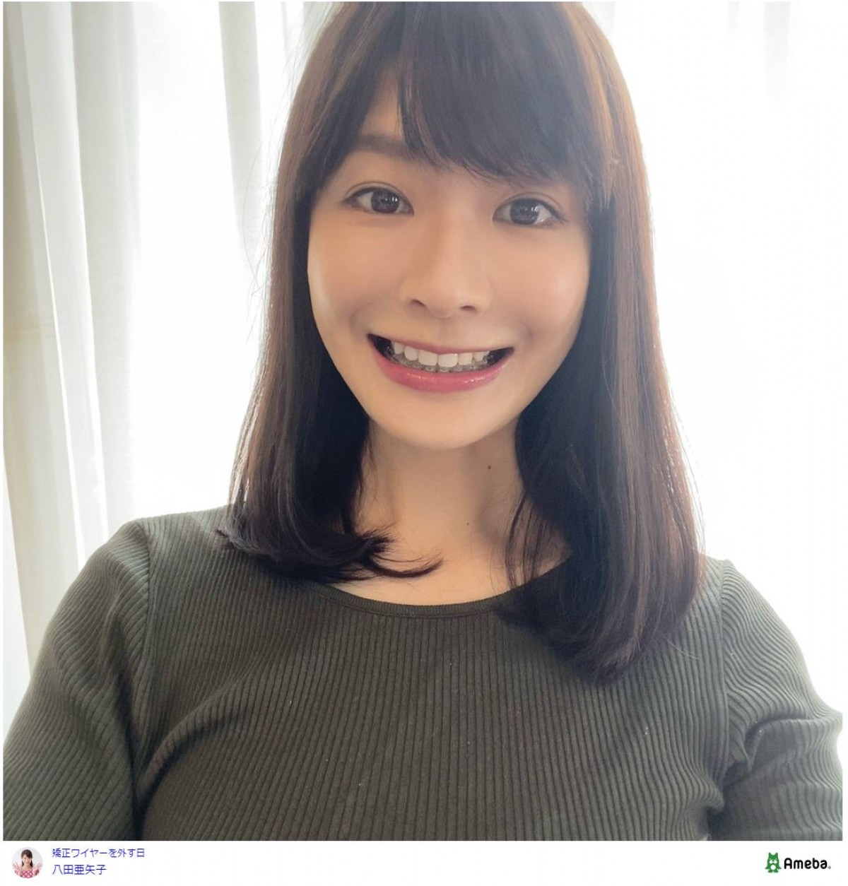 “歯のアップデート”で別人級変身した芸能人のビフォーアフター　“出っ歯”に悩んだモデルが掛けた金額は？