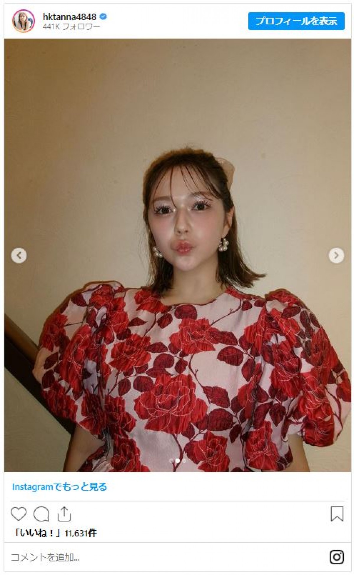 村重杏奈「五億万年ぶりに足を出しました」　レアなミニスカ姿に反響