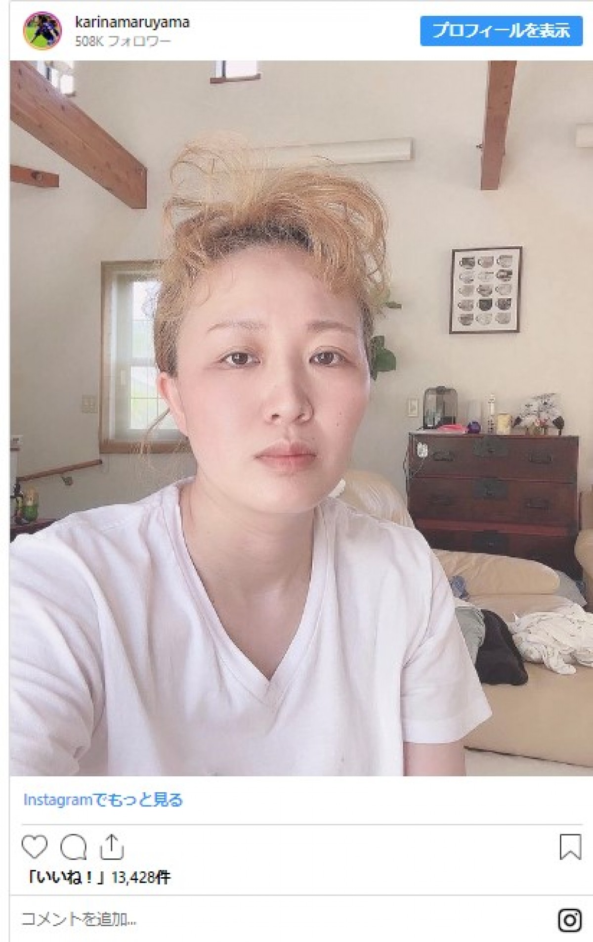人気芸能人の「寝ぐせヘア」コレクション　爆発型、トサカ型、奇跡のハート型も!?