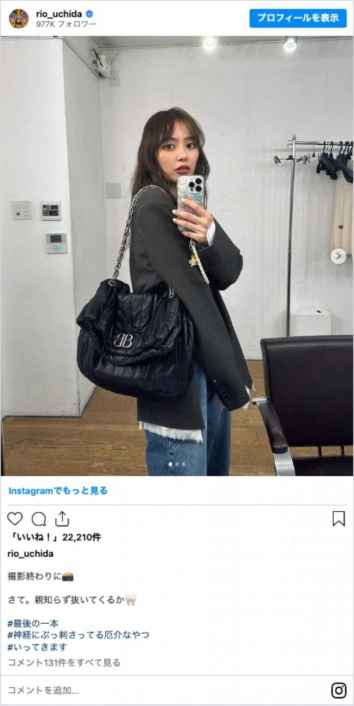 内田理央、親知らず抜いた顔を披露「めっちゃ腫れてる」「痛々しい…」