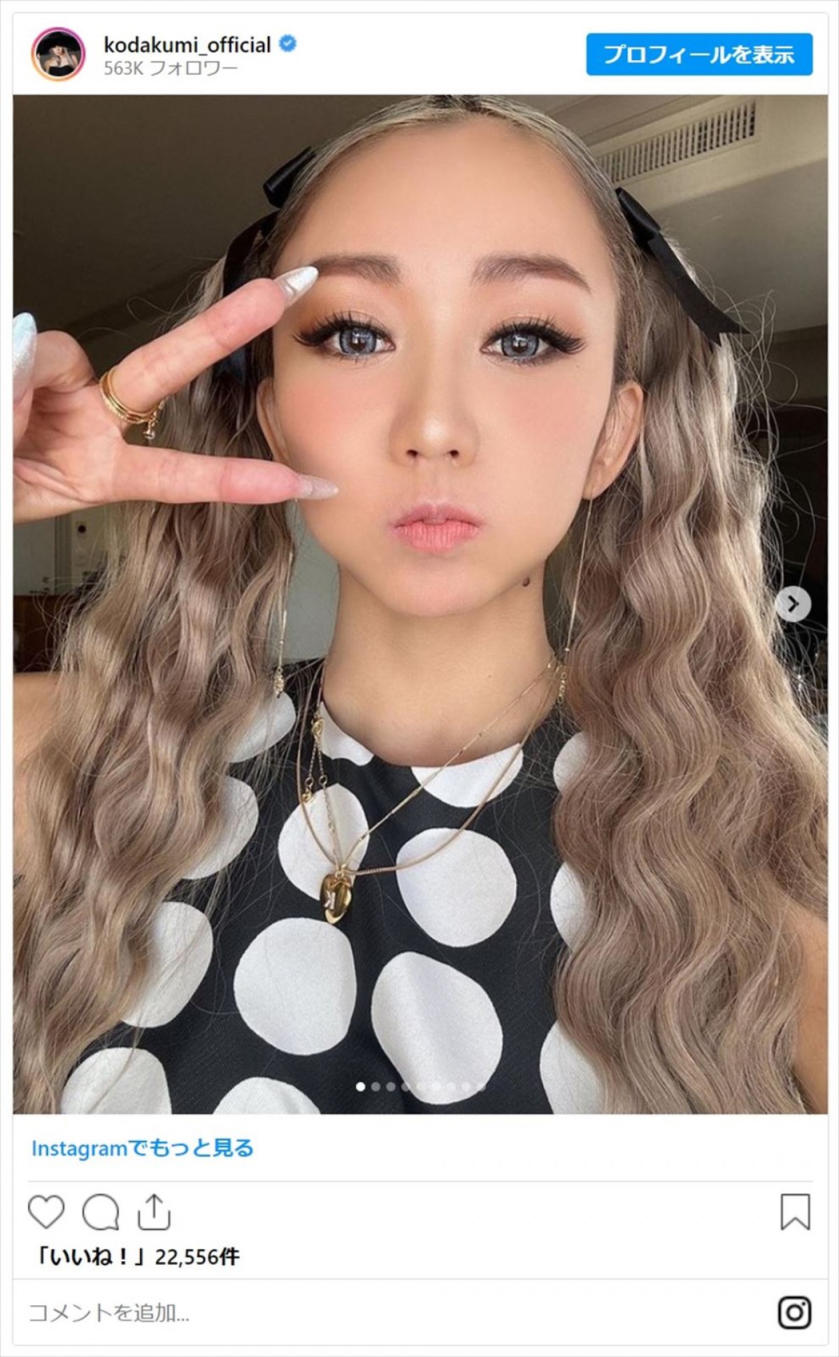 あのちゃんや倖田來未らが魅せる“ツインテール”をファン絶賛「世界一です」「お人形すぎる」＜今日はツインテールの日＞