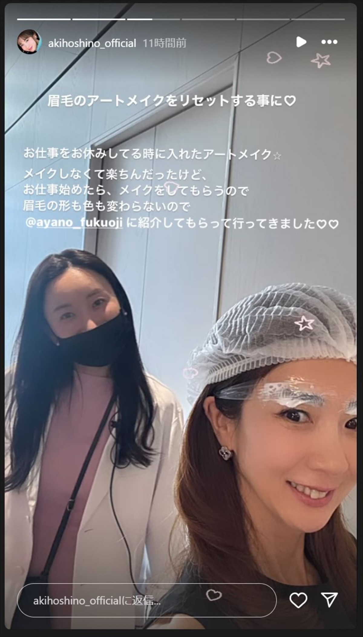 ほしのあき47歳、アートメイク除去のビフォーアフターを披露　お顔が美肌すぎる