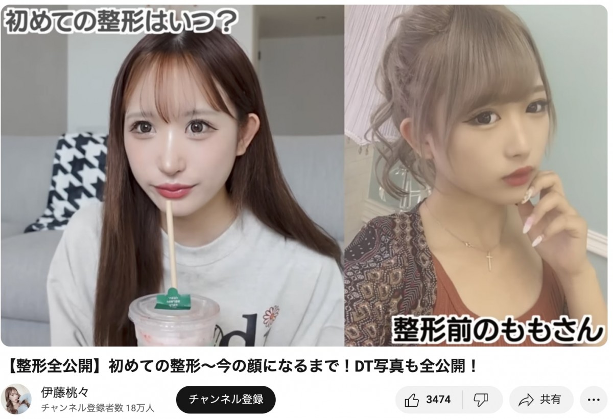 整形公表美女たちのビフォーアフター　総額いくら？　どこを変えたの？　赤裸々告白