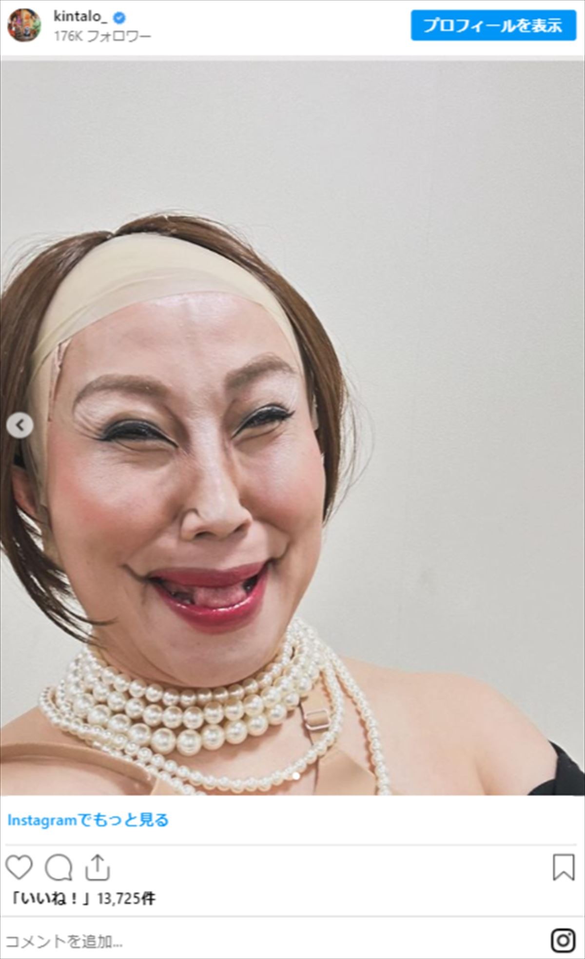 キンタロー。衝撃的なモノマネショットまとめ　国民的人気女優から世界的キャラまで!?