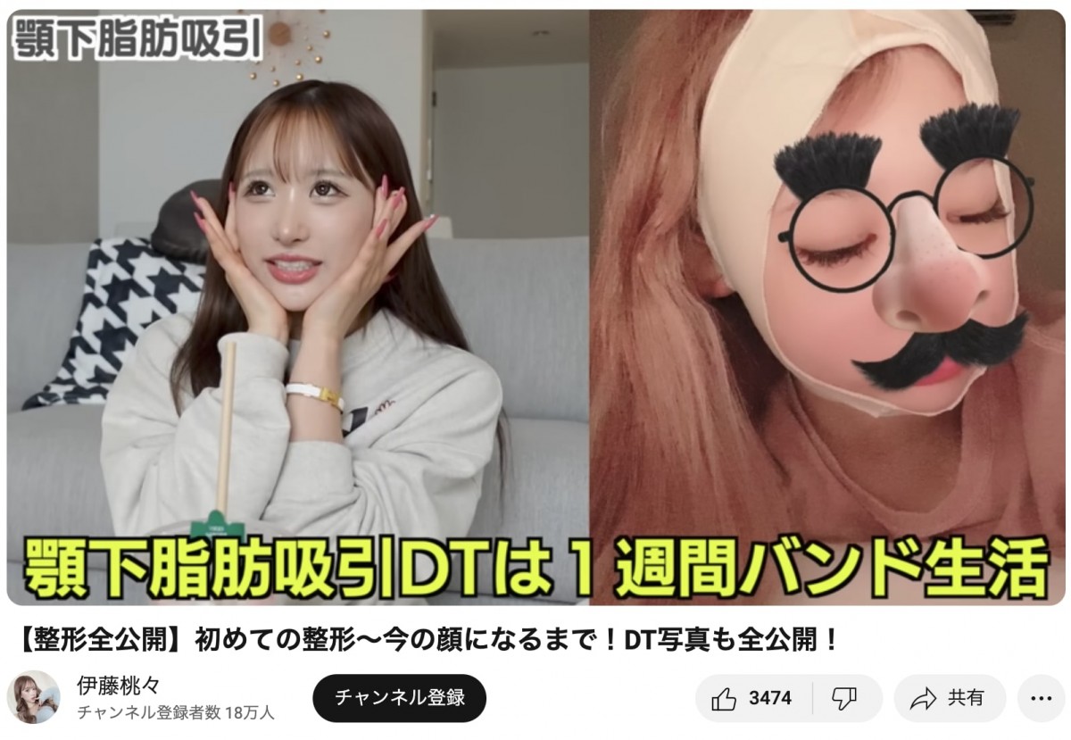 整形公表美女たちのビフォーアフター　総額いくら？　どこを変えたの？　赤裸々告白