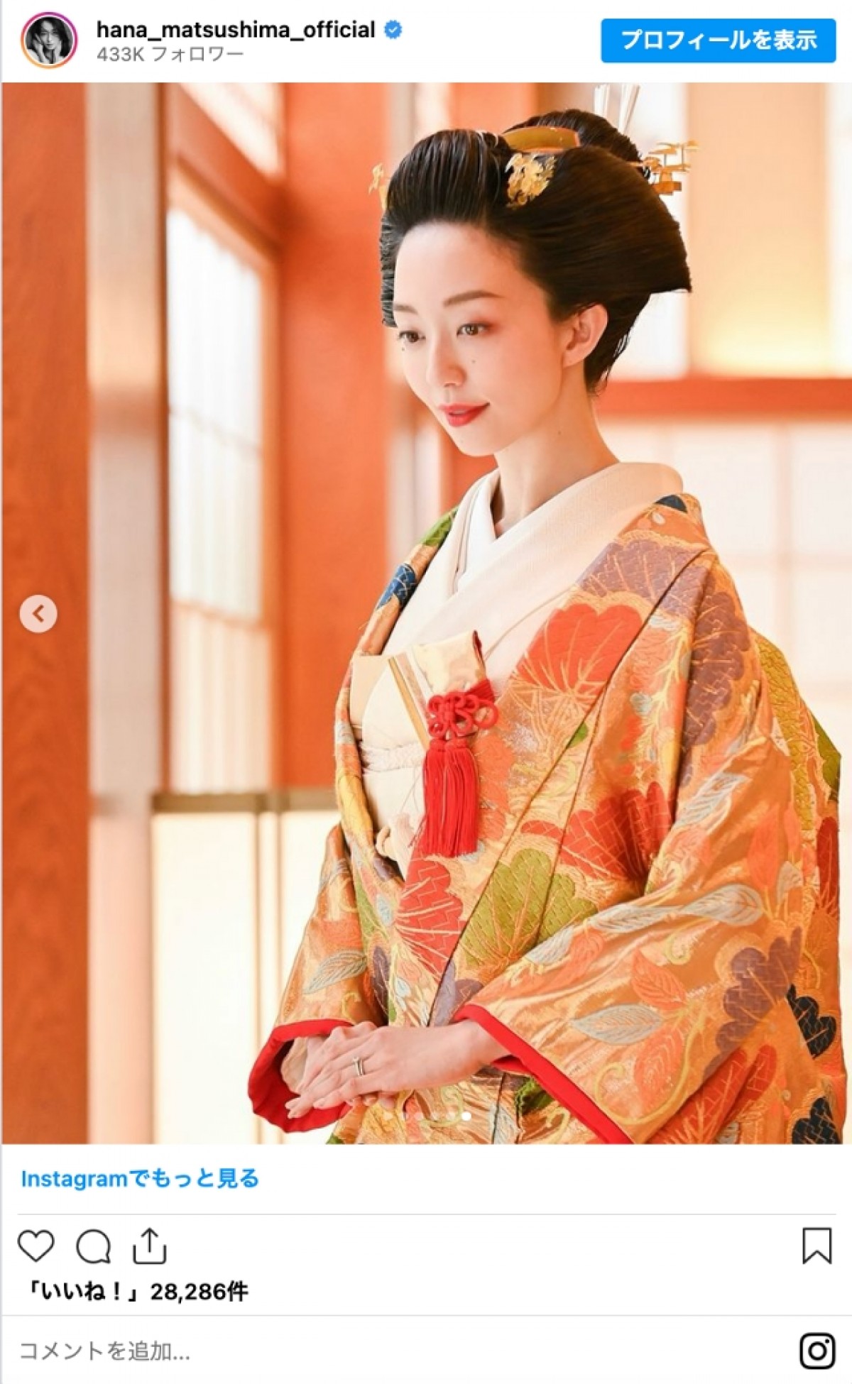 松島花、和装ウェディング姿に「お姫様の婚礼」「日本の宝物」と絶賛の声