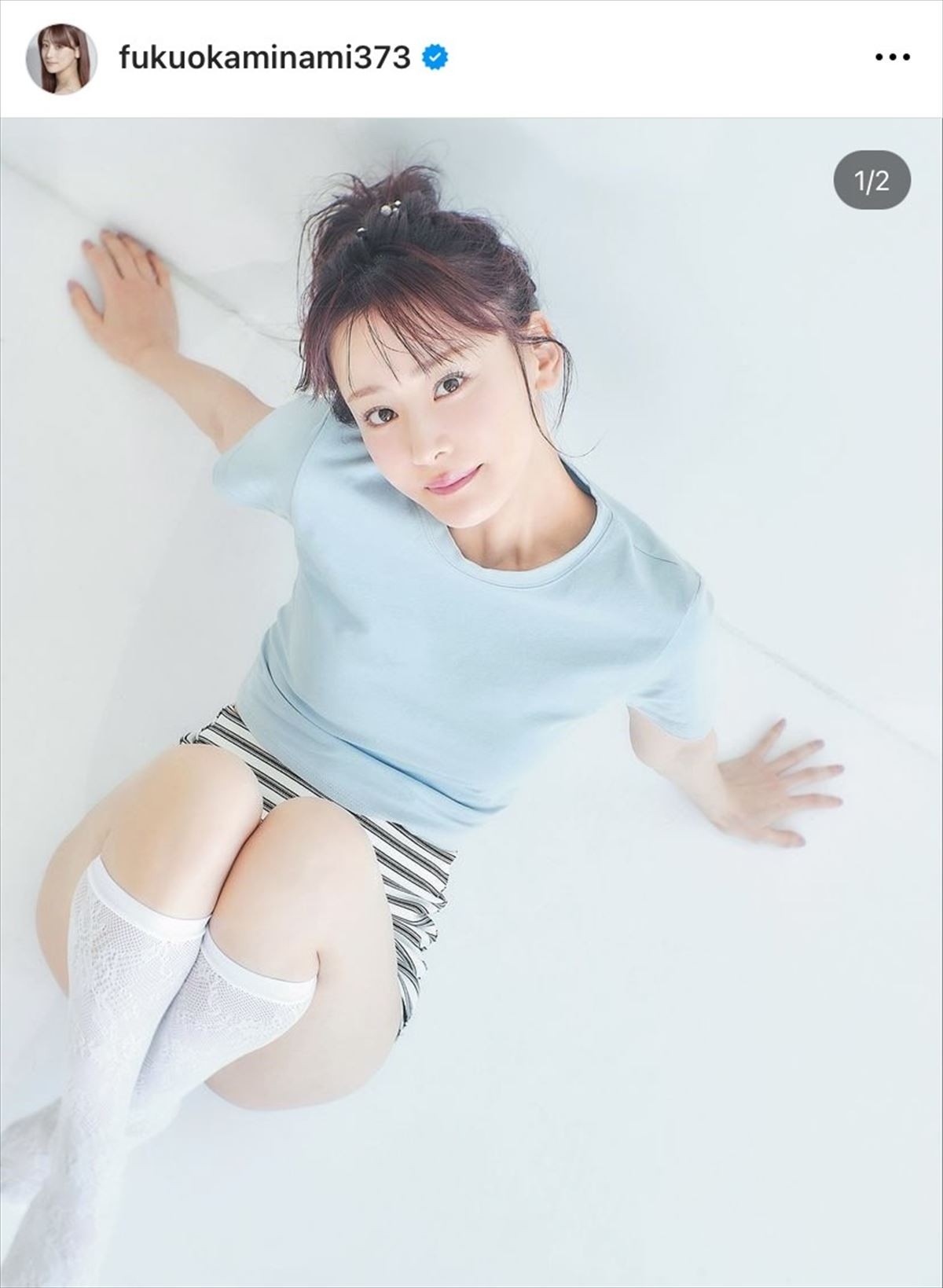 「お仕事のメールが返ってこないと連絡いただいていますが」“整形1億円”タレント、SNSで状況を説明
