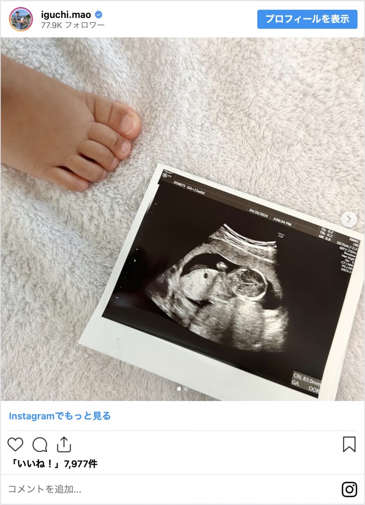 元日向坂46・井口眞緒、第2子出産を報告「3428gの女の子が産まれました」