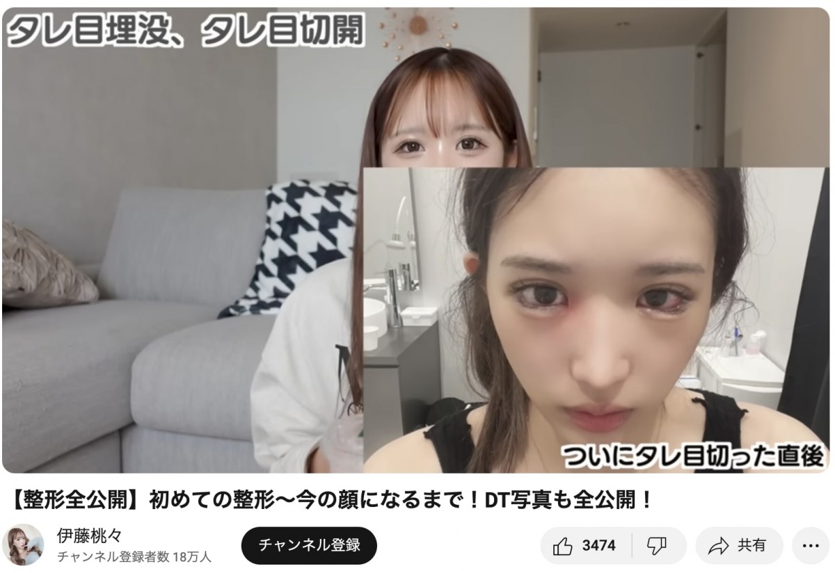 整形公表美女たちのビフォーアフター　総額いくら？　どこを変えたの？　赤裸々告白