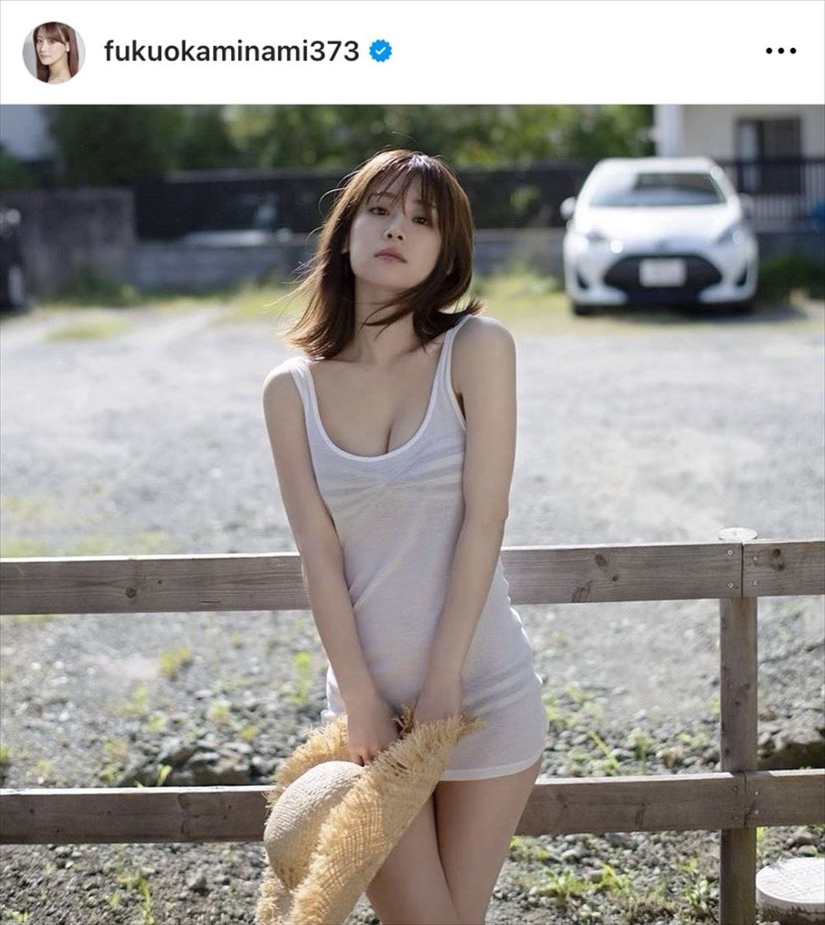 「お仕事のメールが返ってこないと連絡いただいていますが」“整形1億円”タレント、SNSで状況を説明
