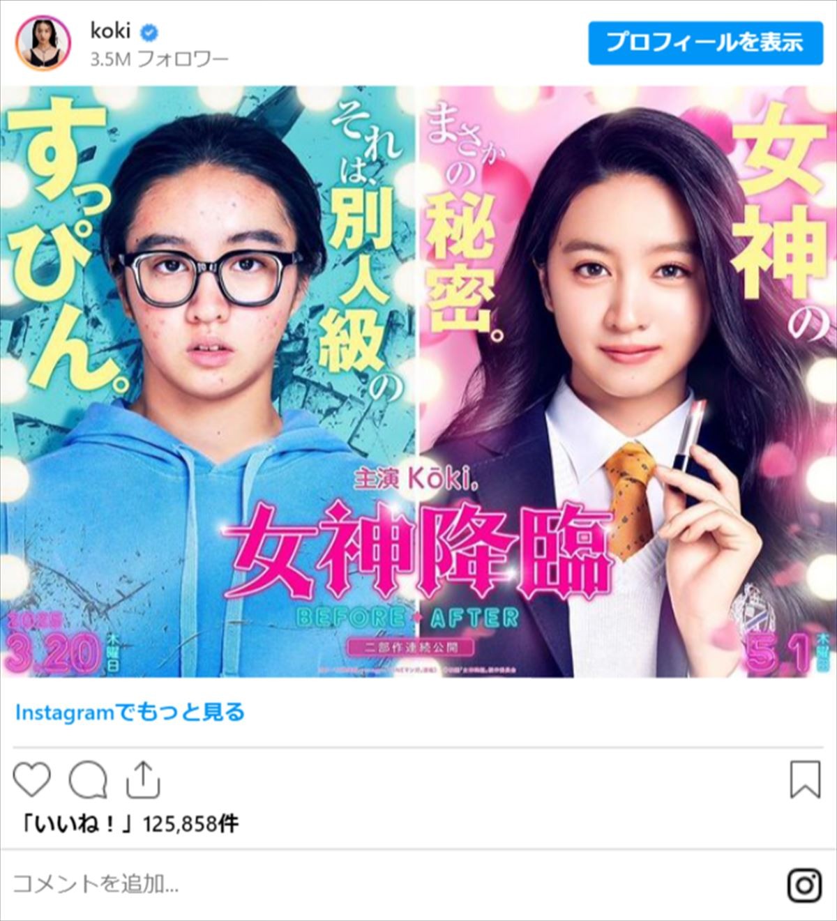 Koki、別人のように“激変”　ラブコメ初挑戦に「結構振り切ってて楽しみ」の声
