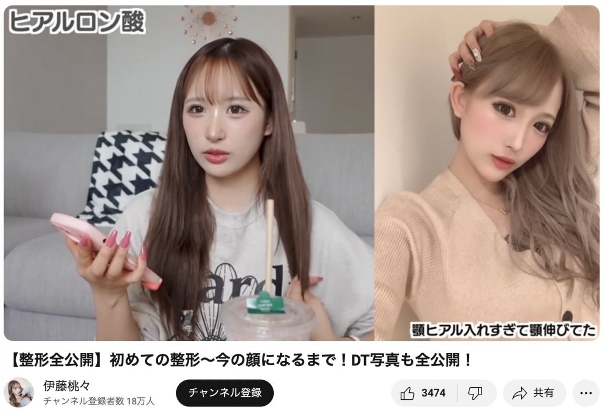 整形公表美女たちのビフォーアフター　総額いくら？　どこを変えたの？　赤裸々告白