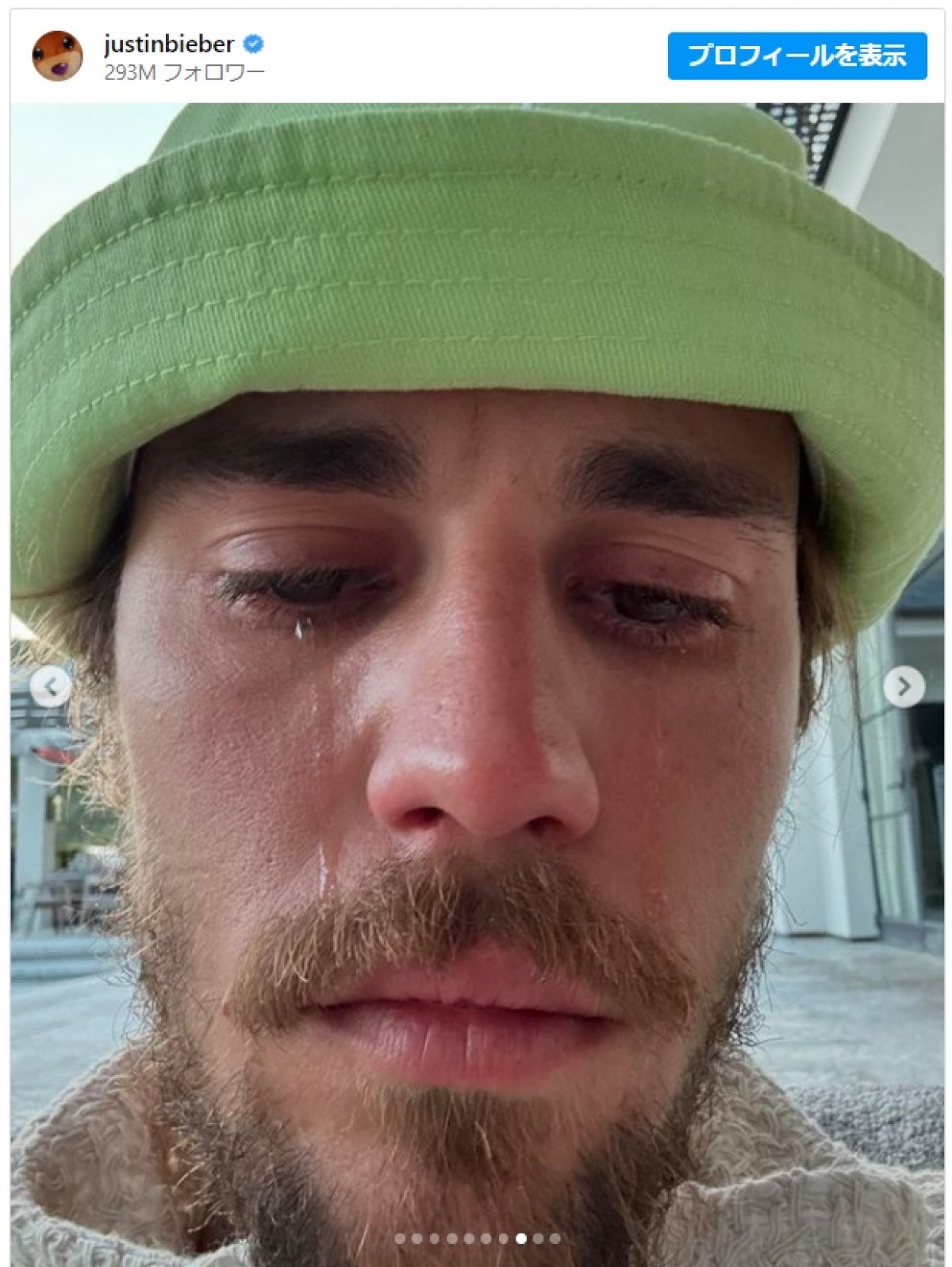 ジャスティン・ビーバーがインスタで涙　ファンをザワつかせる※「Justin Bieber」インスタグラム