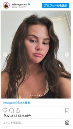 セレーナ・ゴメス、整形疑惑を否定「本当に嫌」※「Selena Gomez」インスタグラム