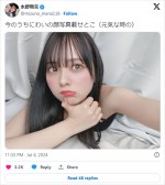 【写真】元アイドル23歳「健康なあの頃に戻りたい」“後遺症”心配の声も　“豚肉の生焼け”でまさかの事態