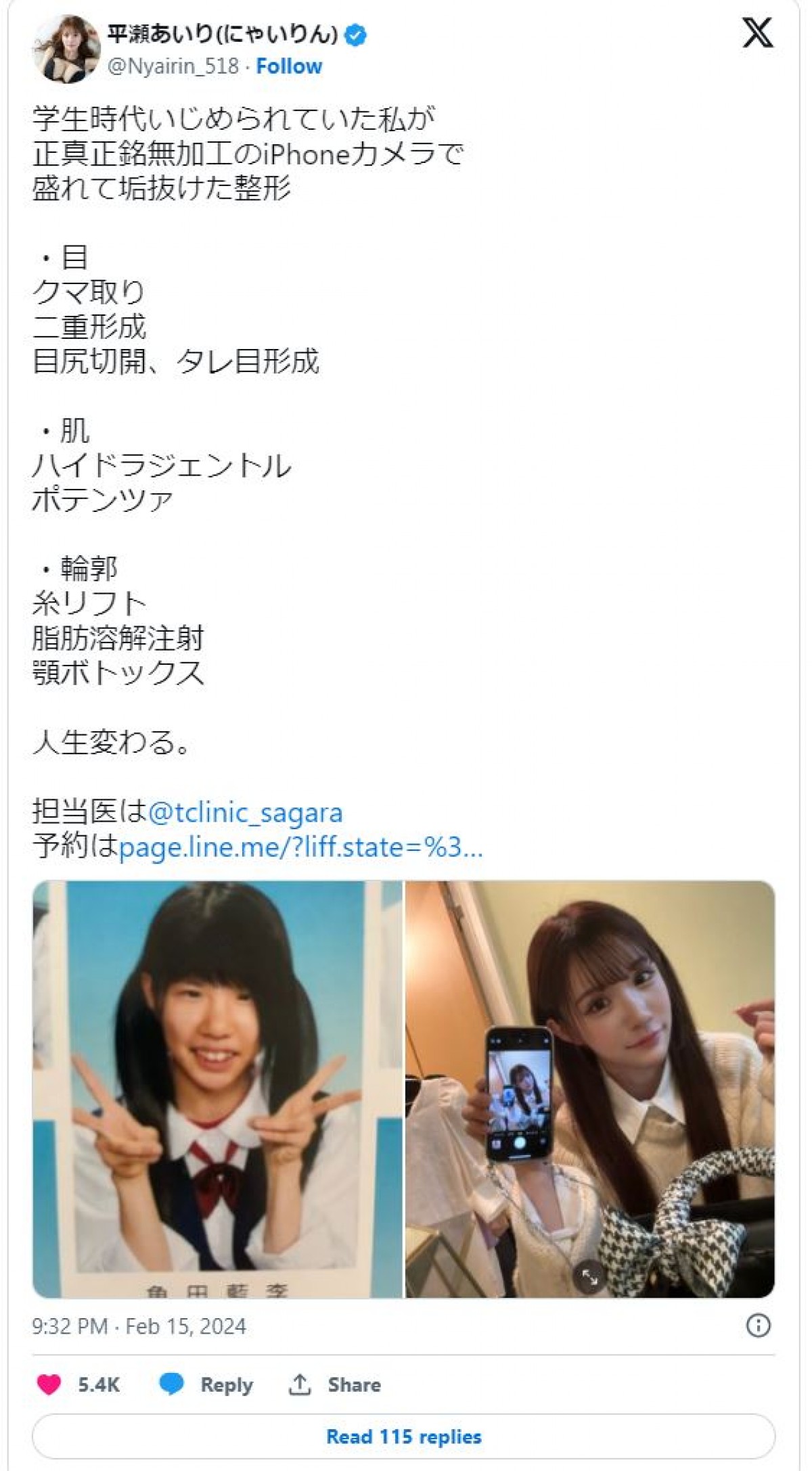 整形公表美女たちのビフォーアフター　総額いくら？　どこを変えたの？　赤裸々告白