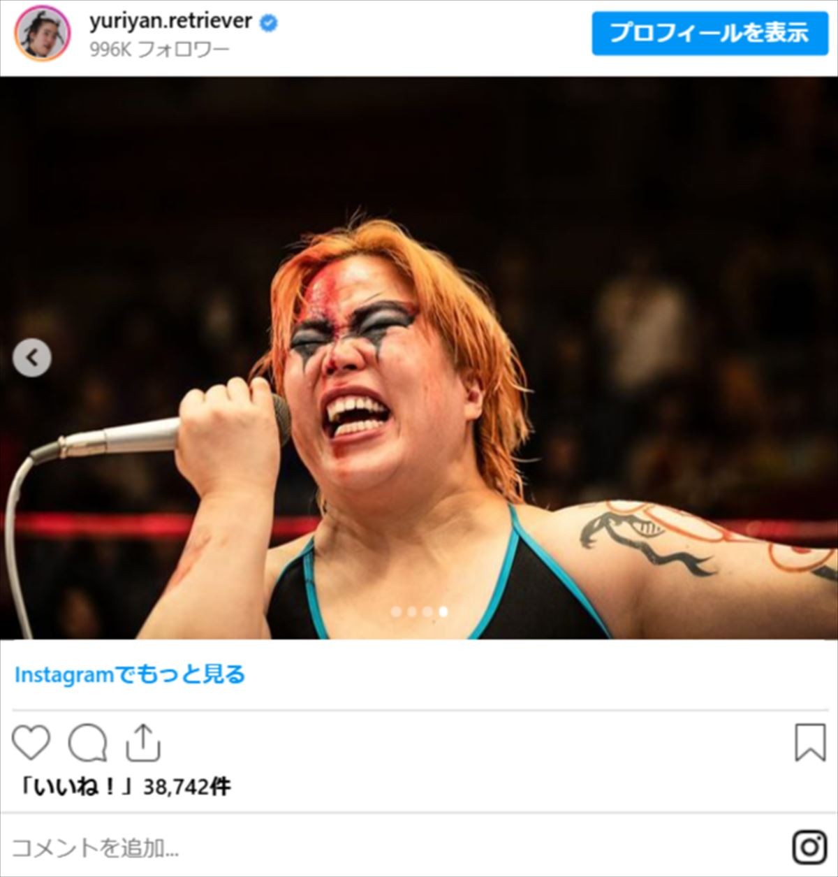 鈴木亮平だけじゃない！　役作りで“体重激変”の芸能人　ビフォーアフターショット