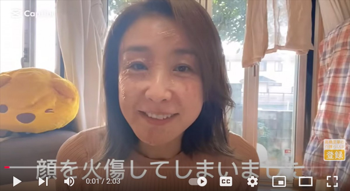 元国民的美少女タレント「顔面を大火傷しました」　ファン心配「痛々しい」「キレイなお顔が、、」