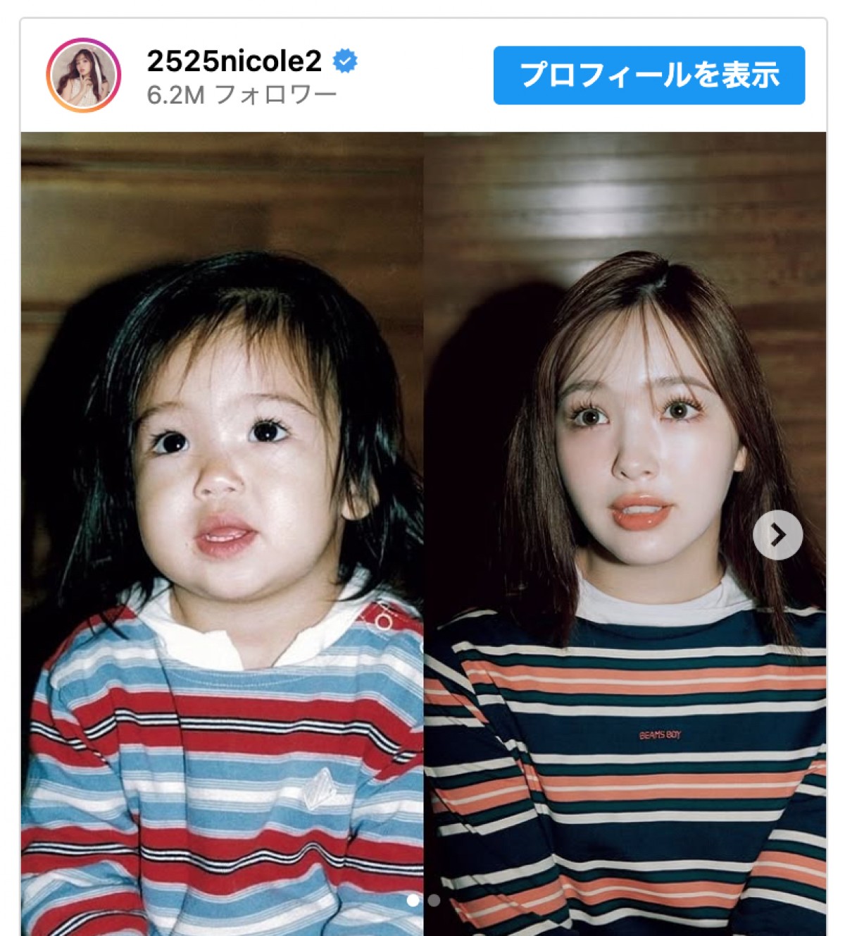 藤田ニコル、幼少期と現在の比較ショットを公開　※「藤田ニコル」インスタグラム