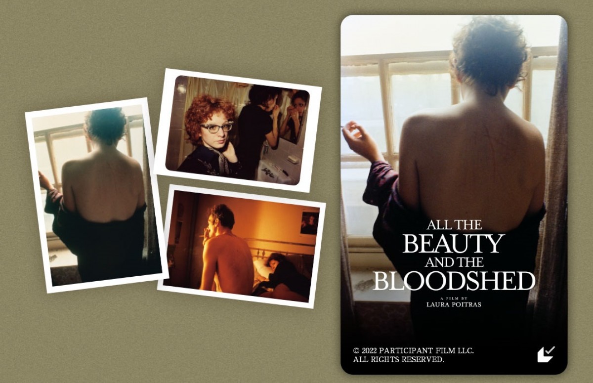 写真家ナン・ゴールディンの人生を記した映画『美と殺戮のすべて』日本版予告編解禁