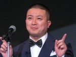 チョコプラ松尾、足に起きた異変に困惑　ファンも心配「尿素クリーム！」「皮膚科へ受診をおすすめします」