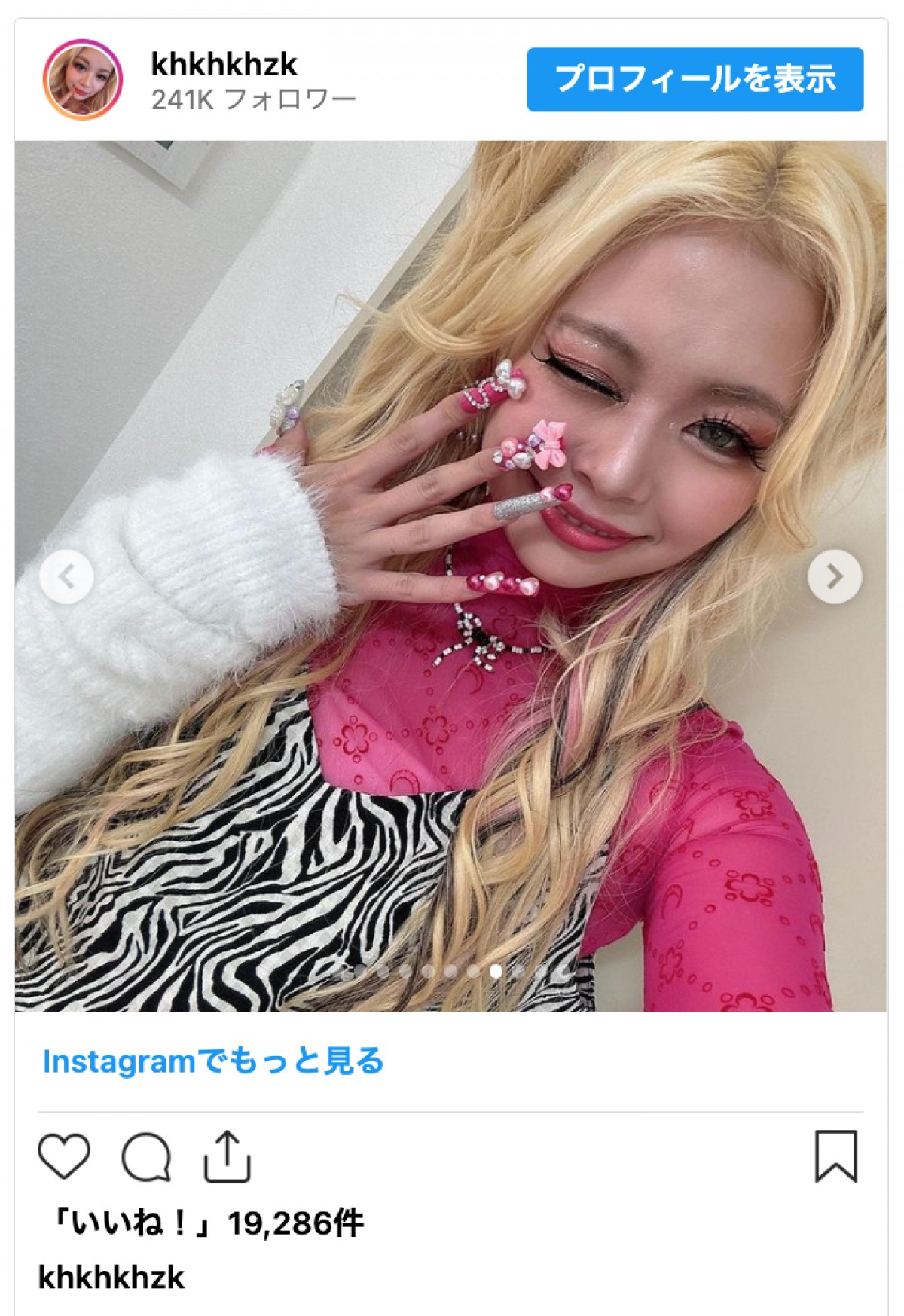 「広瀬すずかと思った」ギャル芸人・エルフ荒川、別人級の激変姿が話題に
