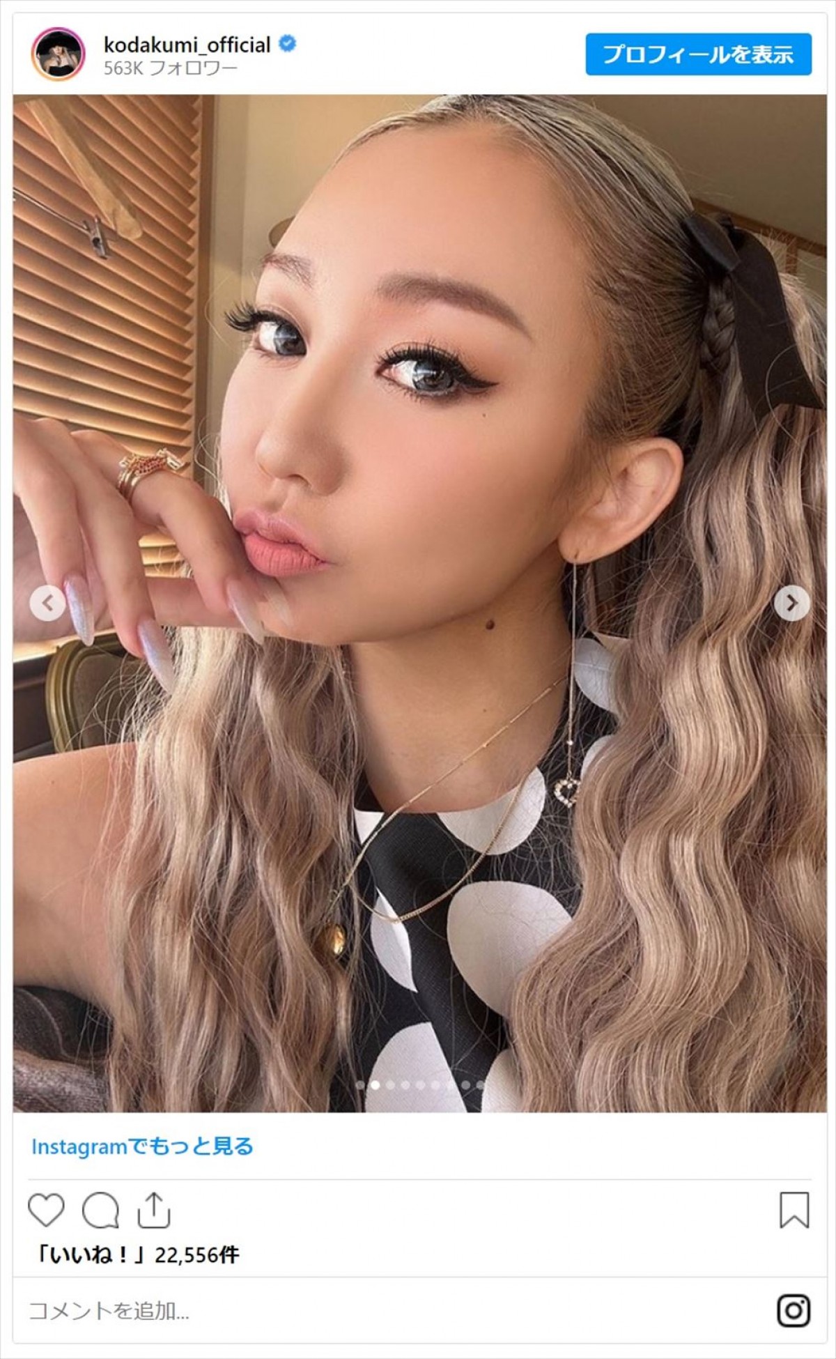 あのちゃんや倖田來未らが魅せる“ツインテール”をファン絶賛「世界一です」「お人形すぎる」＜今日はツインテールの日＞