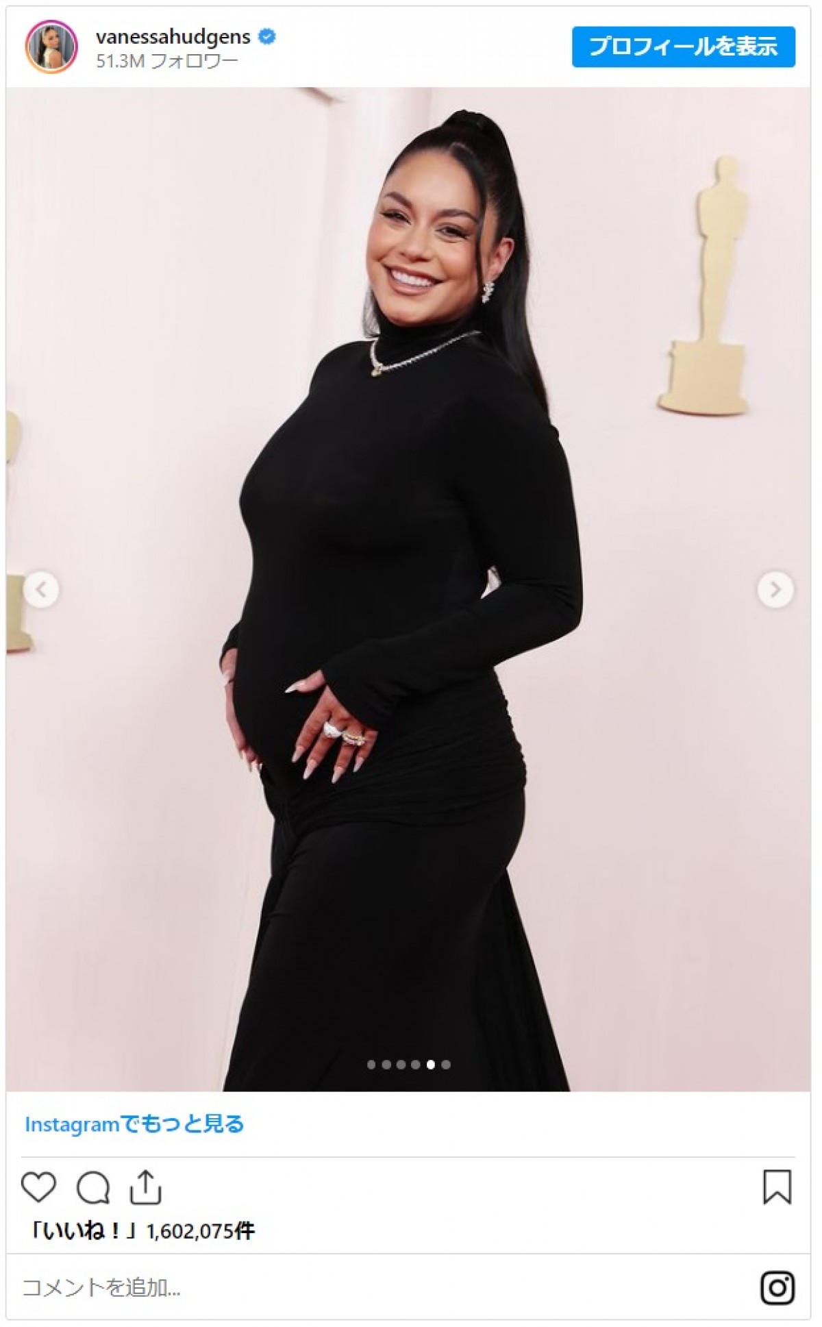 ヴァネッサ・ハジェンズが妊娠発表！　アカデミー賞のレッドカーペットで堂々お披露目