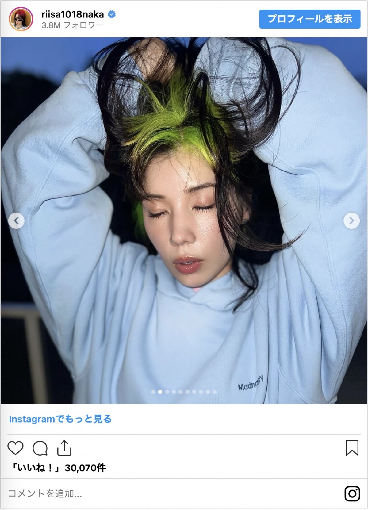 松坂桃李、高畑充希、仲里依紗も！　奇抜な髪色にチェンジした芸能人の変身ショット