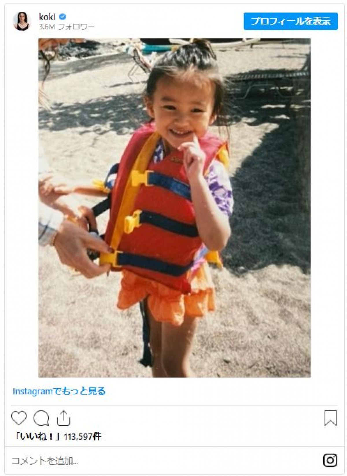 女性芸能人のかわいすぎる“幼少期ショット”　大ブレイク芸人に超有名2世タレントも