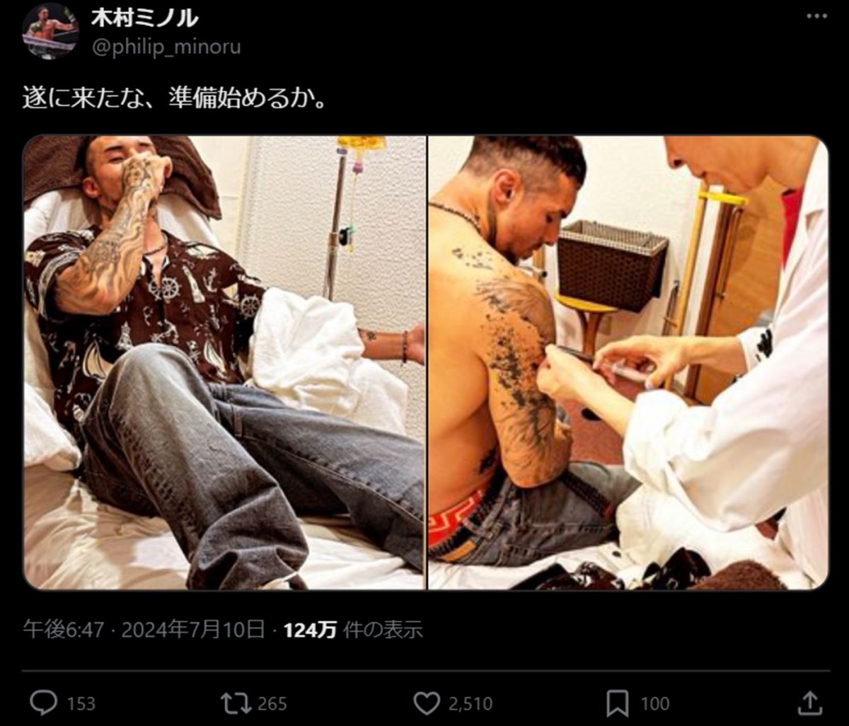 木村ミノルの“SNS投稿”にネット騒然「なんの注射やねん」　ドーピングでRIZIN“出場停止処分”の過去